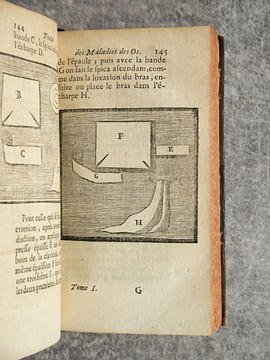 TRAITE DES MALADIES DES OS, DANS LEQUEL ON A REPRESENTE LES APPAREILS ET LES MACHINES QUI CONVIENNENT A LEUR GUERISON, PAR JEN-LOUIS PETIT, DE ...