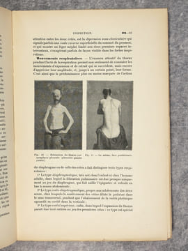SEMIOLOGIE DE L'APPAREIL RESPIRATOIRE, PAR H. BARTH, MEDECIN DE L'HOPITAL NECKER. AVEC 98 FIGURES INTERCALEES DANS LE TEXTE. . BARTH H.