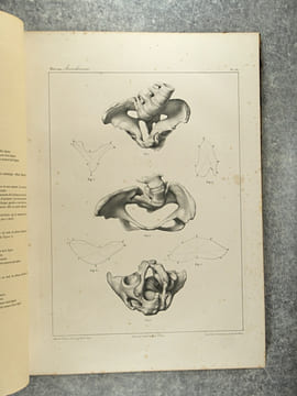 TRAITE PRATIQUE DES ACCOUCHEMENTS PAR F. J. MOREAU. ATLAS DE PLANCHES EXECUTEES D’APRES NATURE PAR EMILE BEAU, SUR LES PREPARATIONS ANATOMIQUES DE M. ...