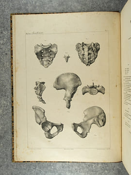 TRAITE PRATIQUE DES ACCOUCHEMENTS PAR F. J. MOREAU. ATLAS DE PLANCHES EXECUTEES D’APRES NATURE PAR EMILE BEAU, SUR LES PREPARATIONS ANATOMIQUES DE M. ...