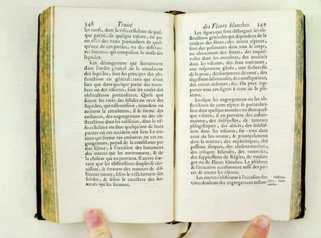 Traité des Fleurs Blanches, avec la méthode de les guérir (Tome 2). RAULIN, M. [ RAULIN, Joseph (1708-1784) ]