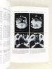 La tomographie par reconstruction. Computed tomography. SALAMON, G. [ Salamon, Georges (1931-2015) ] ; CAILLE, J.M. [ Caillé, Jean-Marie ]