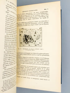 Maladies des méninges ( Nouveau Traité de Médecine et de Thérapeutique , Brouardel et Gilbert, XXXV )