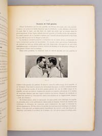 Diagnostic Ophtalmoscopique d'après des reproductions types de Fonds d'Yeux, avec examen spécial des cas importants de médecine générale pour les médecins et les étudiants (2 tomes, complet)