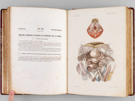 Atlas d'Anatomie descriptive du Corps Humain. Quatrième Partie : Appareil génito-urinaire, organes de la respiration.. BONAMY, C. ; BROCA, Paul ; ...
