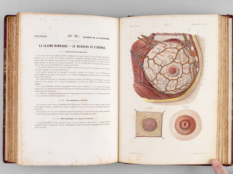 Atlas d'Anatomie descriptive du Corps Humain. Quatrième Partie : Appareil génito-urinaire, organes de la respiration.. BONAMY, C. ; BROCA, Paul ; ...