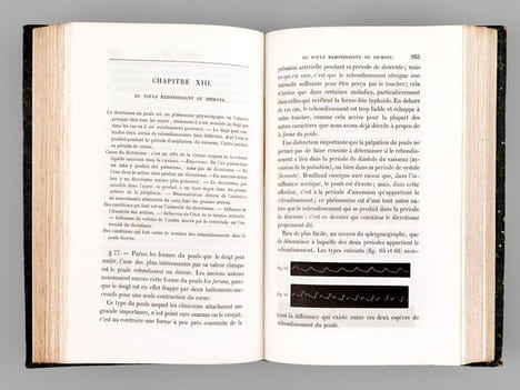Physiologie médicale de la Circulation du Sang basée sur l'Etude graphique des mouvements du Coeur et du Pouls artériel avec application aux maladies ...