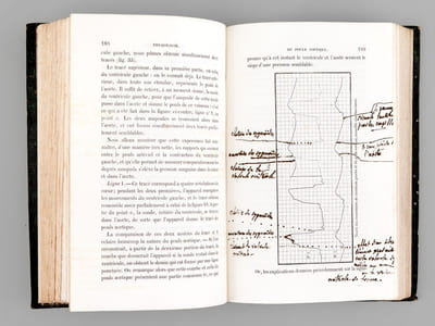 Physiologie médicale de la Circulation du Sang basée sur l'Etude graphique des mouvements du Coeur et du Pouls artériel avec application aux maladies de l'appareil circulatoire [ Edition originale ]