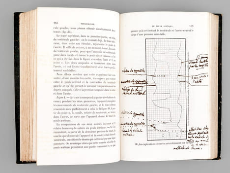 Physiologie médicale de la Circulation du Sang basée sur l'Etude graphique des mouvements du Coeur et du Pouls artériel avec application aux maladies ...