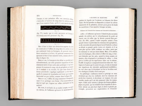 Physiologie médicale de la Circulation du Sang basée sur l'Etude graphique des mouvements du Coeur et du Pouls artériel avec application aux maladies ...