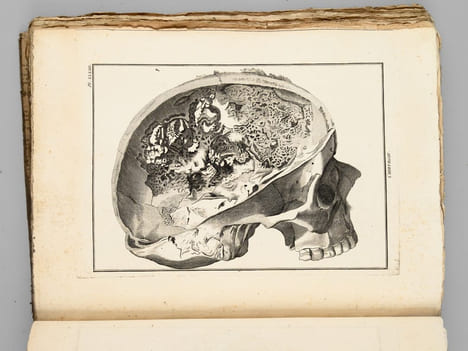 Encyclopédie Méthodique. Chirurgie (2 Tomes de Dictionnaire de Chirurgie et d'Explication des Planches et 1 Vol. de Planches - Complet) [ Edition ...