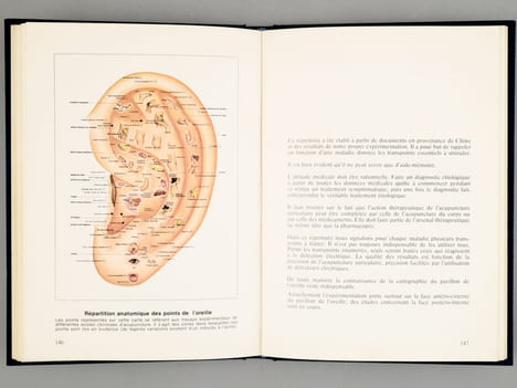 Traité d'acupuncture auriculaire. . GROBGLAS, André , LEVY, Jacques