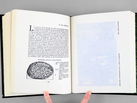 Oeuvres [ Oeuvres complètes - 4 Tomes : Complet ] . PARE, Ambroise ; (GUERRAND, Roger-Henri ; DE BISSY, Fernande) 