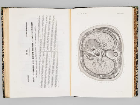 Atlas d'anatomie descriptive du corps humain. Quatrième partie. Appareil génito-urinaire, organes de la respiration.. BONAMY, Constantin ; BROCA, Paul ...