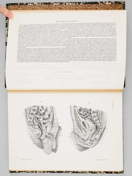 Atlas d'anatomie descriptive du corps humain. Quatrième partie. Appareil génito-urinaire, organes de la respiration.. BONAMY, Constantin ; BROCA, Paul ...