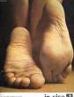 IN VIVO - N°24 TROUBLES TROPHIQUE DU PIED. COLLECTIF