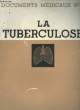 Documents Médicaux N°2 : La Tuberculose.. COLLECTIF