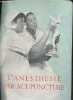 L'anesthesie par acupuncture.. Collectif