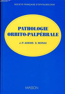 Pathologie orbito-palpébrale - Collection Société française d'ophtalmologie.