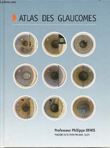 Atlas des glaucomes.