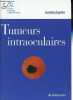 Tumeurs intraoculaires - Collection Société française d'ophtalmologie.. Zografos Leonidas