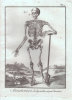 Anatomie. Planches provenant de la Nouvelle édition du Dictionnaire raisonné des sciences, des arts et des métiers, avec leur explication. . 