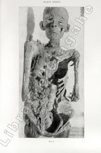 Studies in the palaeopathology of Egypt.
