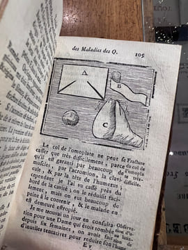 Traité des maladies des os, dans lequel on a représenté les Appareils & les Machines qui conviennent à leur guérison. M. Petit - M. Louis