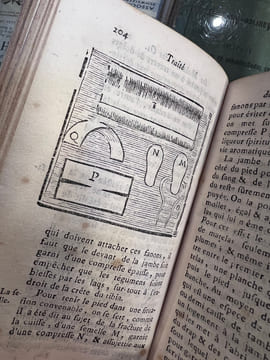 Traité des maladies des os, dans lequel on a représenté les Appareils & les Machines qui conviennent à leur guérison. M. Petit - M. Louis