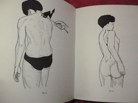 LA PRATIQUE DE LA MÉDECINE MANUELLE. J.E.H Niboyer