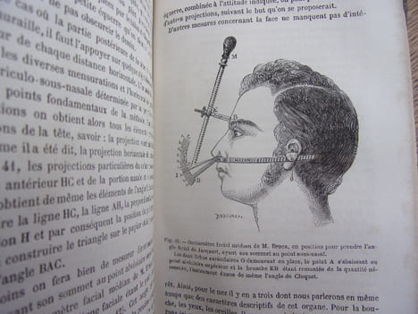 l'Anthropologie. Paul Topinard