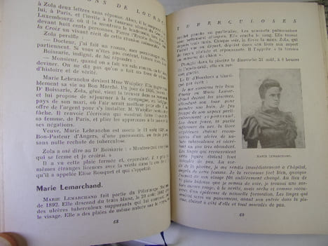 LES GUÉRISONS DE LOURDES. Joseph Belleney