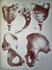 Manuel d'anatomie descriptive du corps humain (5 volumes) . CLOQUET Jules Germain