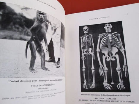 LA GREFFE DE REVITALISATION HUMAINE.Sa portée,son avenir,ses résultats.Greffage sexuel Anthropoido-Anthropique du testicule dU Singe dans les bourses ...
