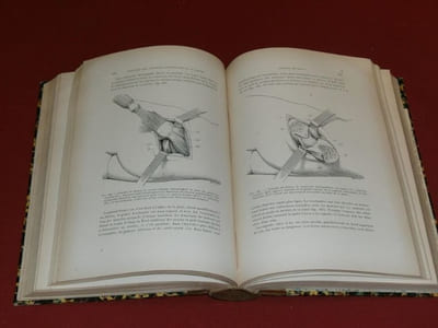 Traité de Médecine Opératoire et de Thérapeutique Chirurgicale : Chirurgie Orthopédique par le Professeur Paul Berger et le Docteur S. Banzet. 