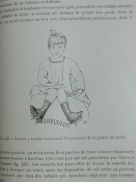 Traité de Médecine Opératoire et de Thérapeutique Chirurgicale : Chirurgie Orthopédique par le Professeur Paul Berger et le Docteur S. Banzet. . ...