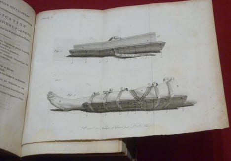 Leçons du C.en Boyer, sur Les Maladies des Os, rédigées en un Traité Complet de ces Maladies par Anth. Richerand.. RICHERAND, Anthelme - BOYER, ...