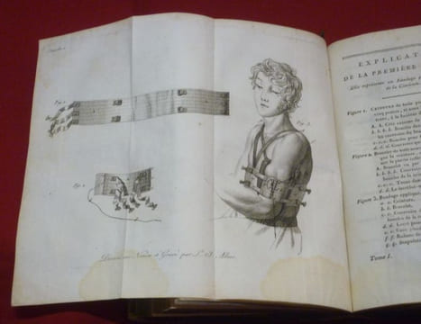 Leçons du C.en Boyer, sur Les Maladies des Os, rédigées en un Traité Complet de ces Maladies par Anth. Richerand.. RICHERAND, Anthelme - BOYER, ...