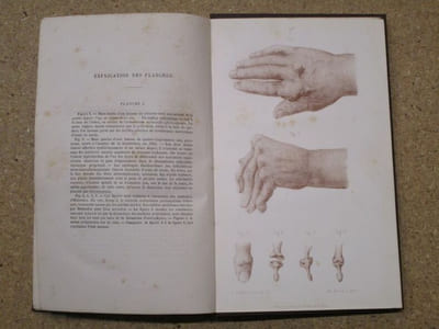 Leçons cliniques sur les maladies des vieillards et les maladies chroniques.