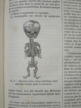 Encyclopédie internationale de Chirurgie publiée sous la direction du Docteur John Ashhurst et illustrée de figures intercallées dans le texte. Tome I ...