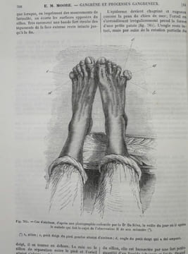 Encyclopédie internationale de Chirurgie publiée sous la direction du Docteur John Ashhurst et illustrée de figures intercallées dans le texte. Tome I ...