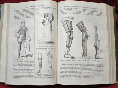 Encyclopédie internationale de Chirurgie publiée sous la direction du Docteur John Ashhurst et illustrée de figures intercallées dans le texte. Tome I ...
