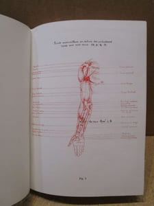 L'Acuponcture ( acupuncture ) chinoise (2 volumes).  