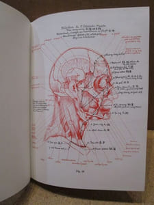 L'Acuponcture ( acupuncture ) chinoise (2 volumes).  
