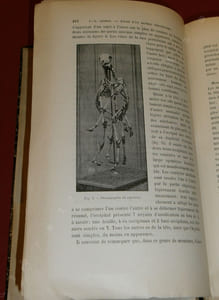 Mélanges Tératologiques.LESBRE - RABAUD.