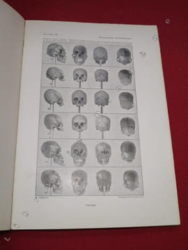Anthropologie Bolivienne (3 volumes).. CHERVIN, Arthur.