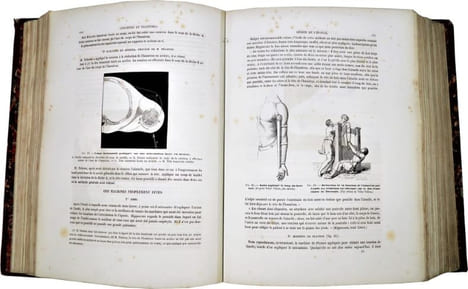 Traité iconographique des maladies chirurgicales. Précédé d'une introduction par M. Velpeau. Dessins d'après nature par MM. Bion, Léveillé et Beau. . ...