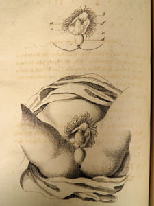 Mémoires de Chirurgie avec quelques remarques historiques sur l’Etat de la Médecine & de la Chirurgie en France & en Angleterre.