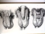 Traité complet de l'anatomie de l'Homme, comprenant la médecine chirurgicale et la médecine opératoire, avec planches lithographiées d'après nature. COLLECTION COMPLÈTE.  par BOURGERY, Jean-Marc ; BERNARD, Claude ; JACOB, Nicolas Henri ; DUCHAUSSOY, Dr.  - Image 15