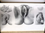 Traité complet de l'anatomie de l'Homme, comprenant la médecine chirurgicale et la médecine opératoire, avec planches lithographiées d'après nature. COLLECTION COMPLÈTE.  par BOURGERY, Jean-Marc ; BERNARD, Claude ; JACOB, Nicolas Henri ; DUCHAUSSOY, Dr.  - Image 16